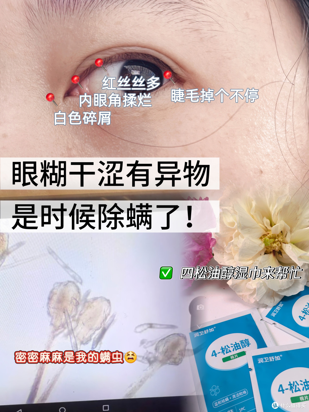 眼角揉烂，后悔没早点用除螨湿巾