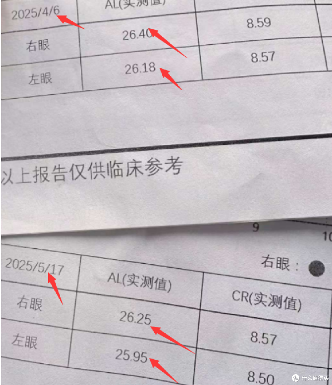 乐睛视力营养素效果怎么样?真的能控制眼轴增长吗?