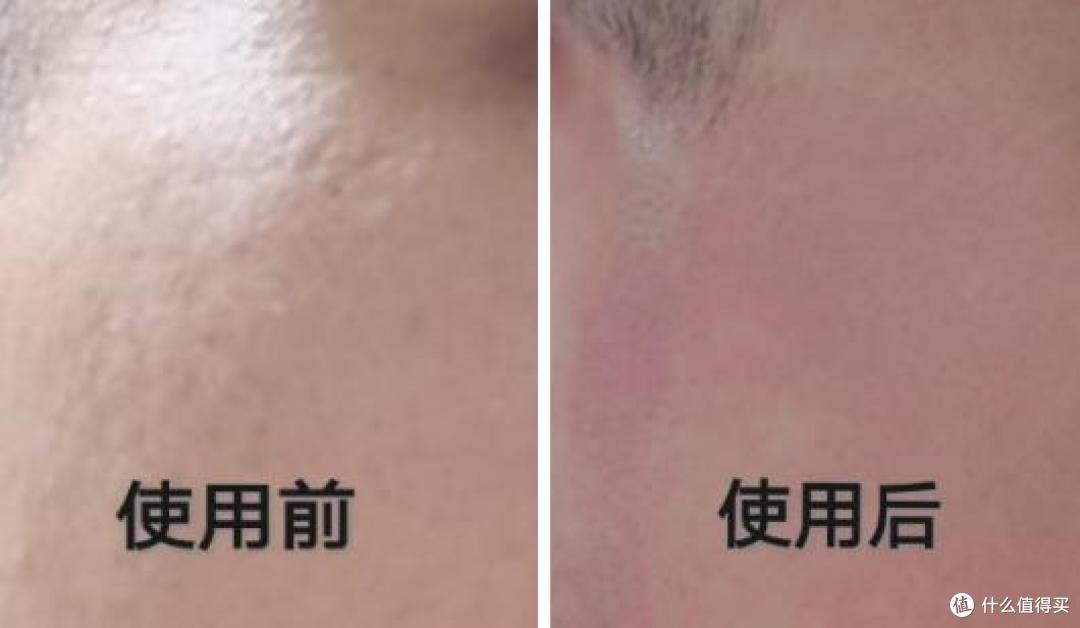 实测珂岸小喷菇系列产品套装,让脸部告别痘痘、暗淡、出油……