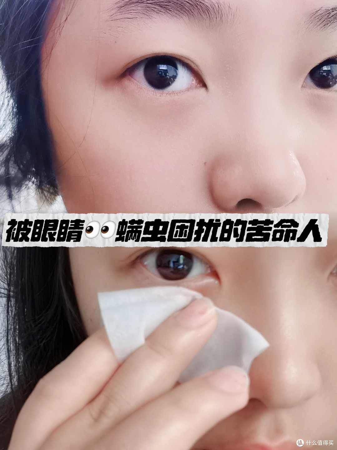 被眼部螨虫困扰的苦命人看过来!