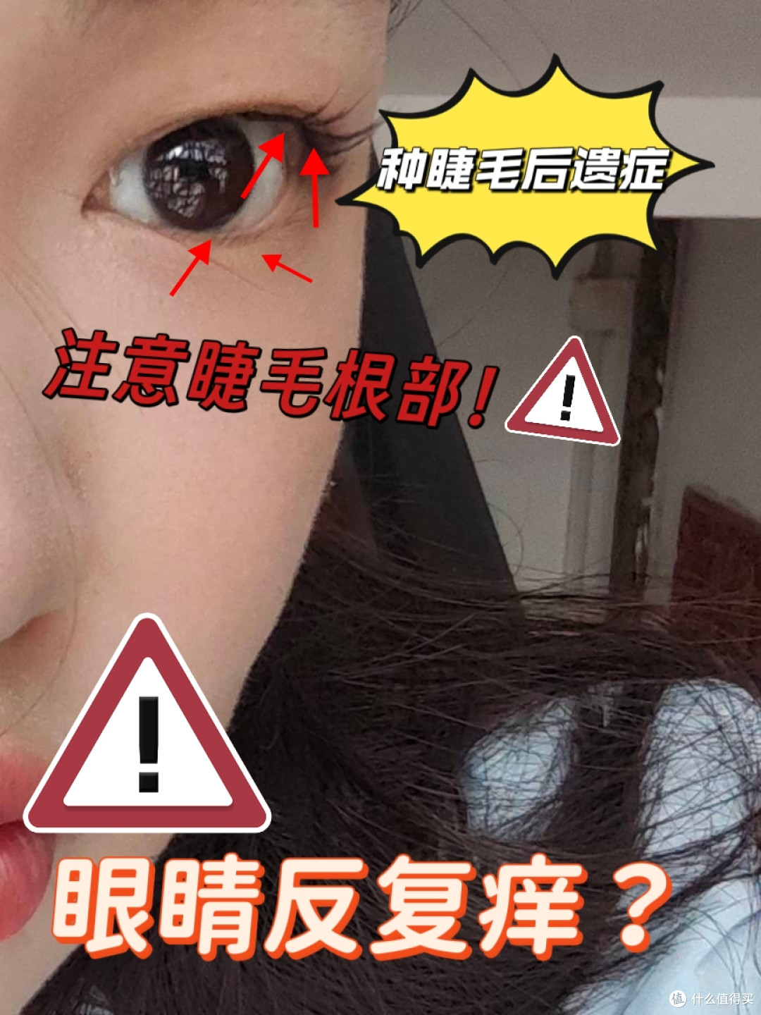 种睫毛后眼睛痒到崩溃?原来都是螨虫在!