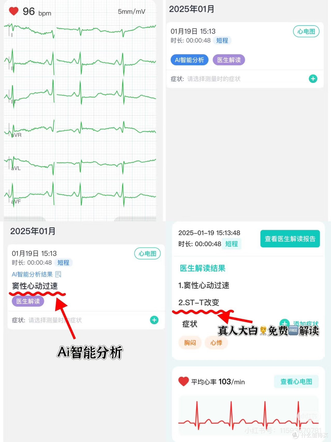产后胸闷的宝妈都给我入这个心电仪!能保命