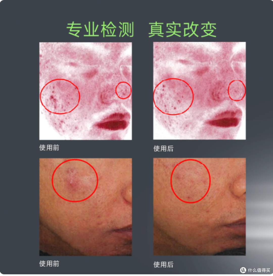 甄然 2% 水杨酸精华 20 支囤货装,28 天刷出平滑鸡蛋肌✨