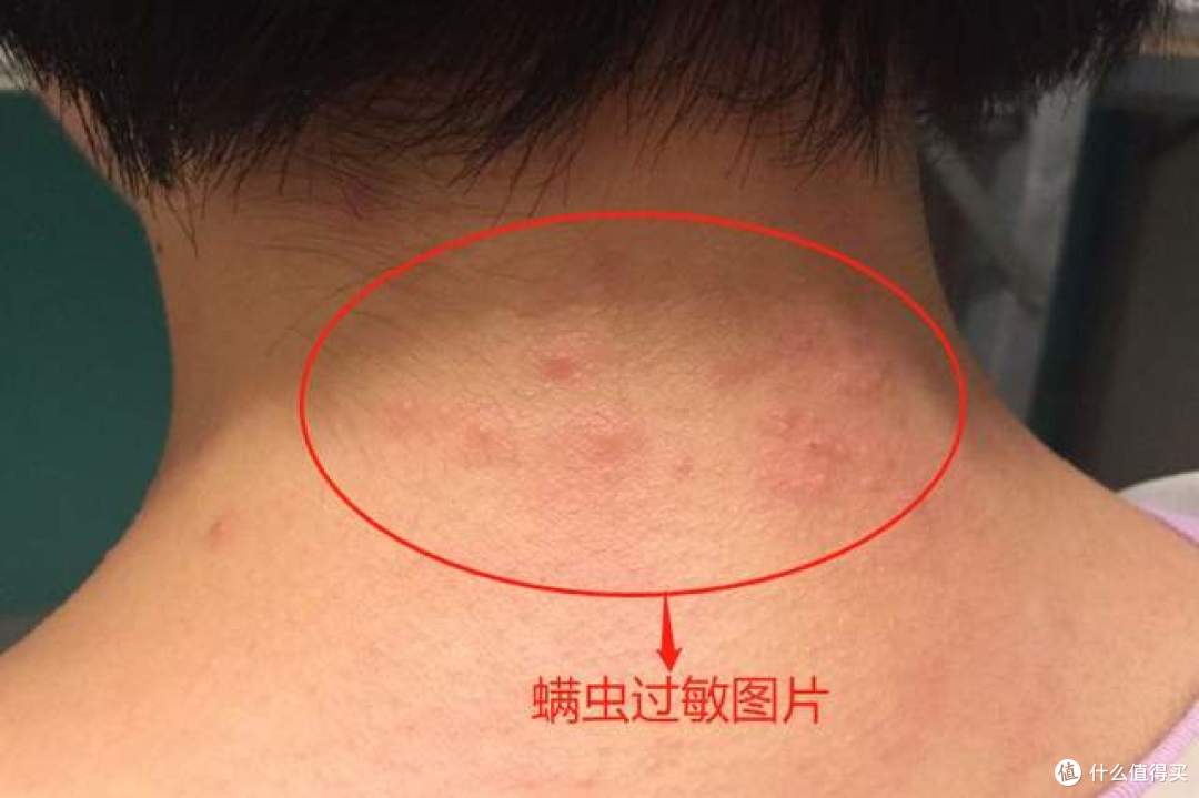 卧室如何除螨？揭秘几种常见除螨方式，学会了轻松告别螨虫！