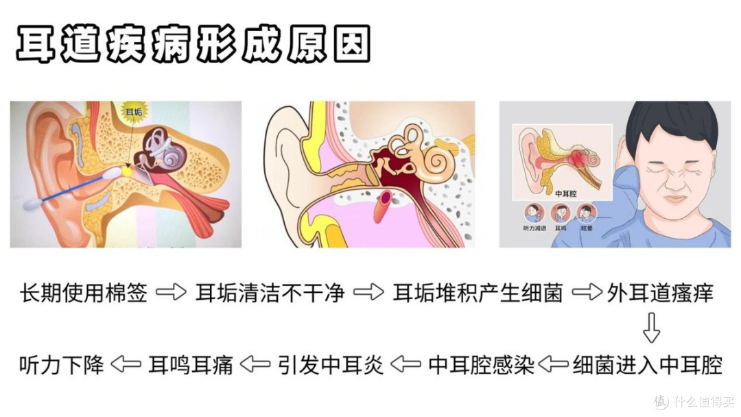 双11可视掏耳勺选购,西圣、蜂鸟、泰视朗、Xlife热门型号怎么选