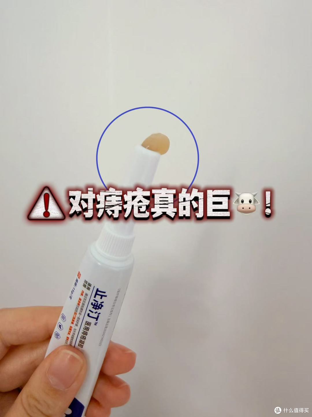 痔疮千万不要拖?一秒教你自测痔疮类型!