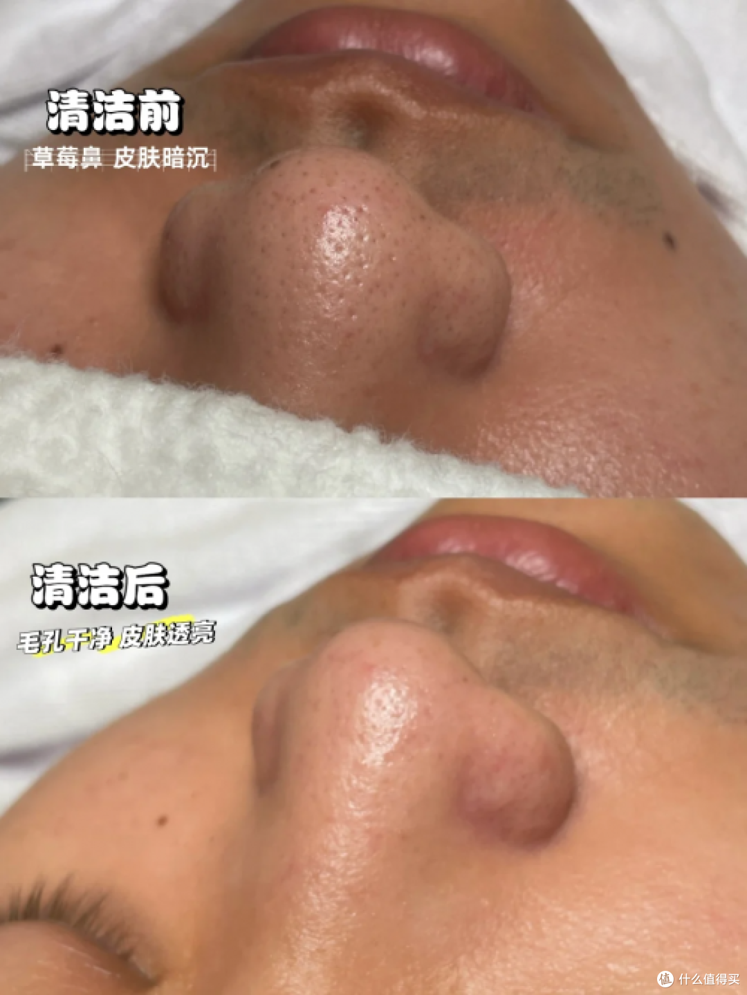 去痘洗面奶排行榜:男士洗面奶哪个牌子最好?十大良心国货洗面奶