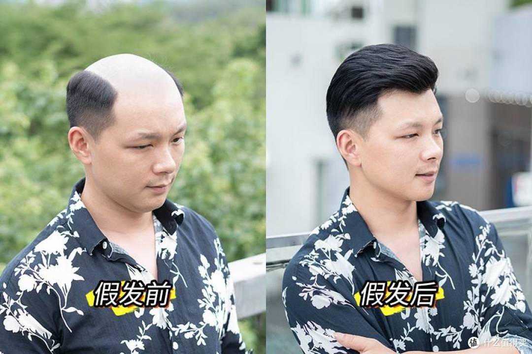 兰州年轻人的“头顶革新”，为何偏爱私密假发定制？