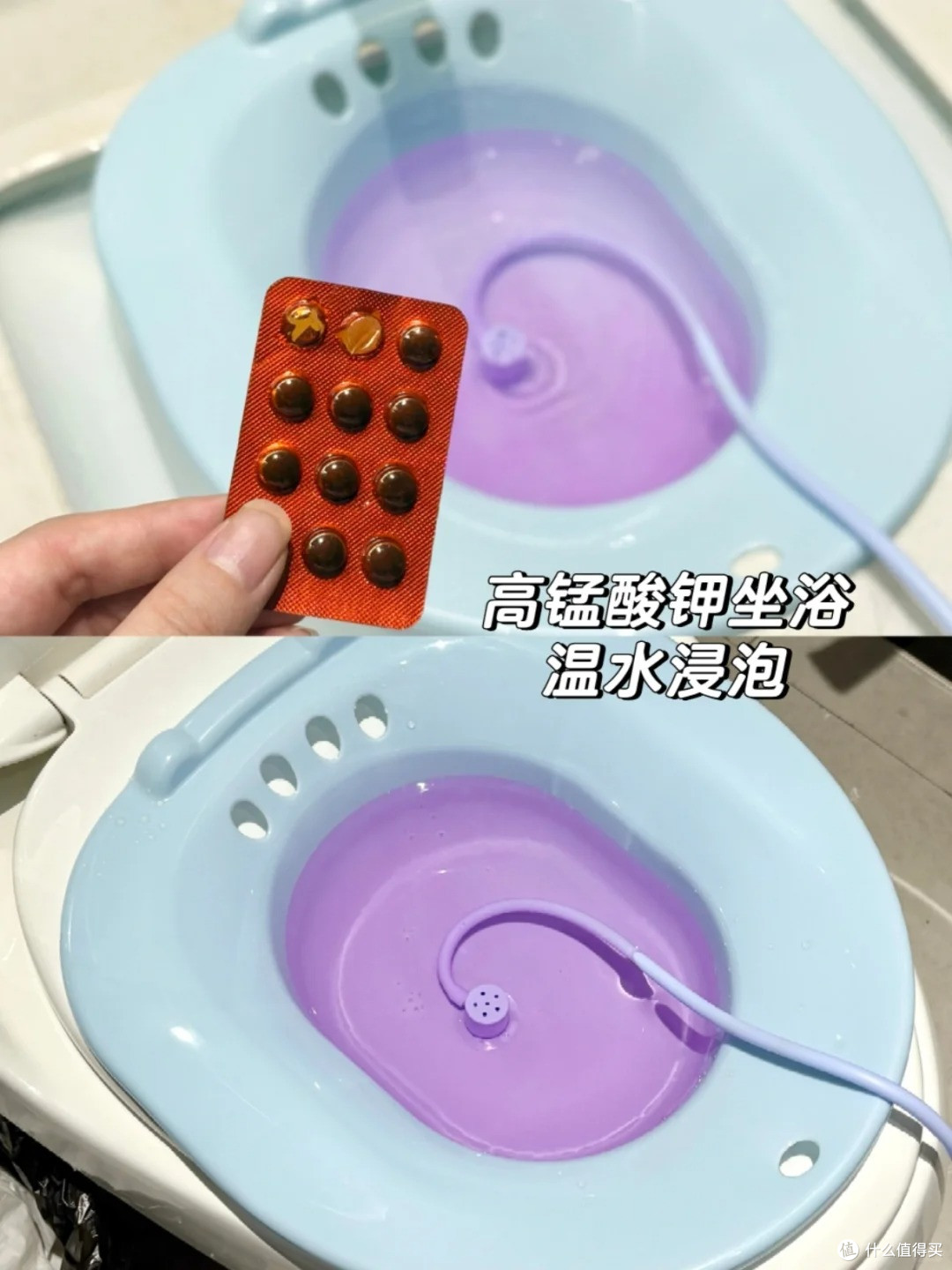 痔疮肉球脱出疼痛难忍？长痔疮必备两件套！