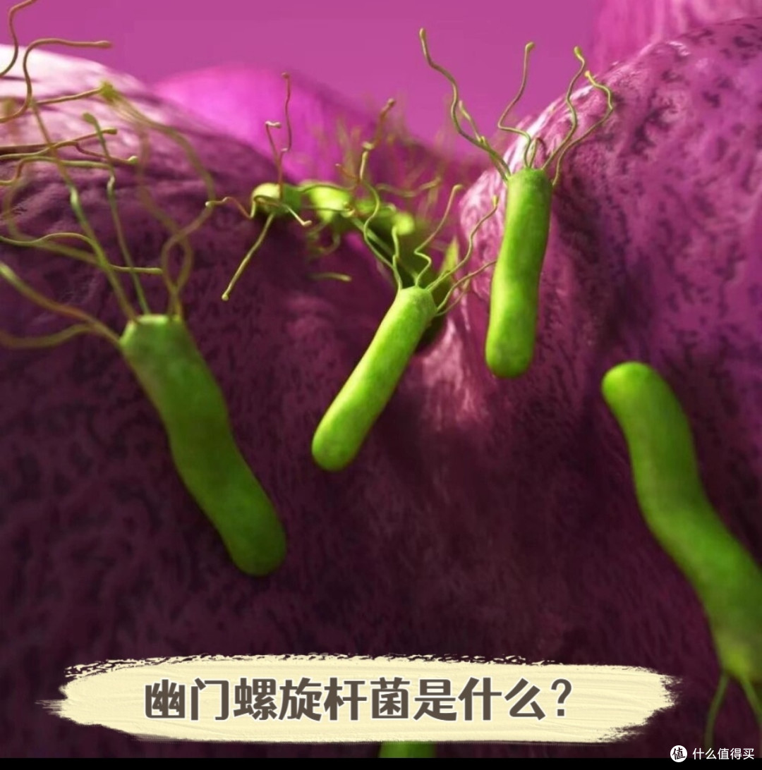 藏在胃里的“隐形杀手”,你可能已经中招了——幽门螺杆菌