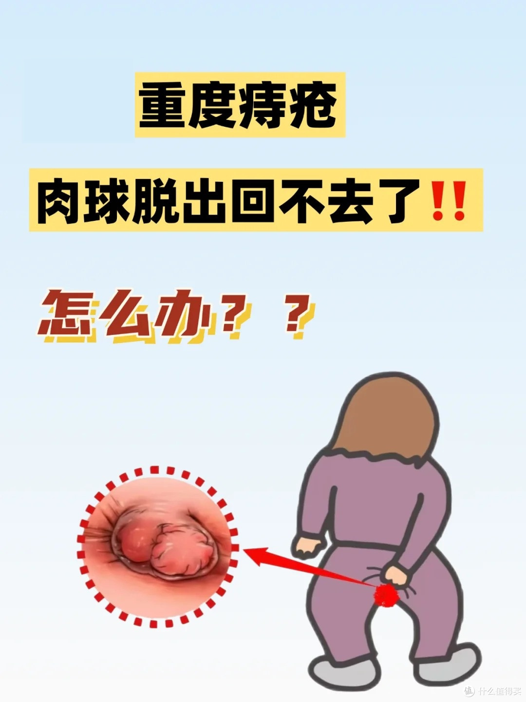 有痔青年的消痔大法！消除痔疮就是这么简单