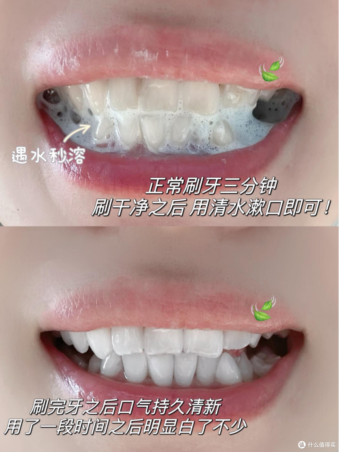没想到牙结石这么容易就被搞定了，后悔没早点知道