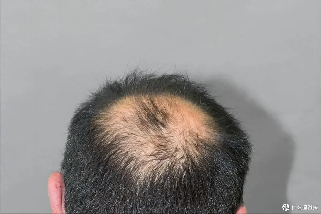 育妍堂,做程序员最靠谱的“发量后盾”