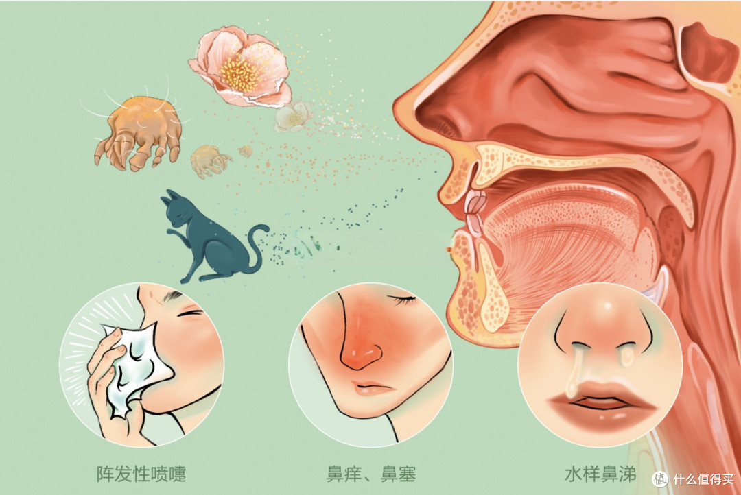 换季鼻炎总不好是螨虫吗？一文理清病因与科学应对方案