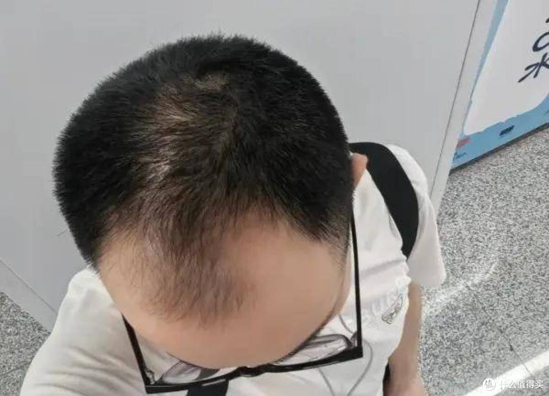 育妍堂养发小建议:销售人发量的温和照顾法