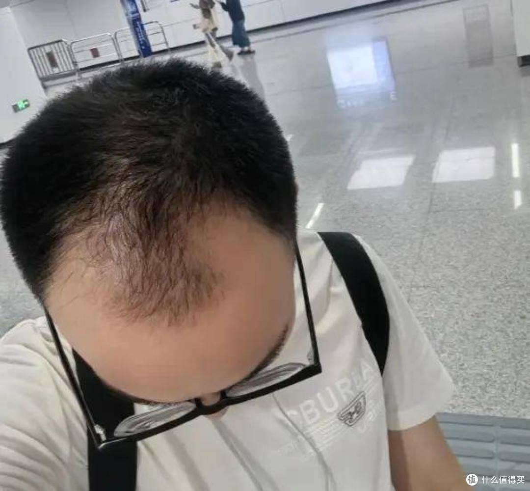 育妍堂养发小建议:销售人发量的温和照顾法