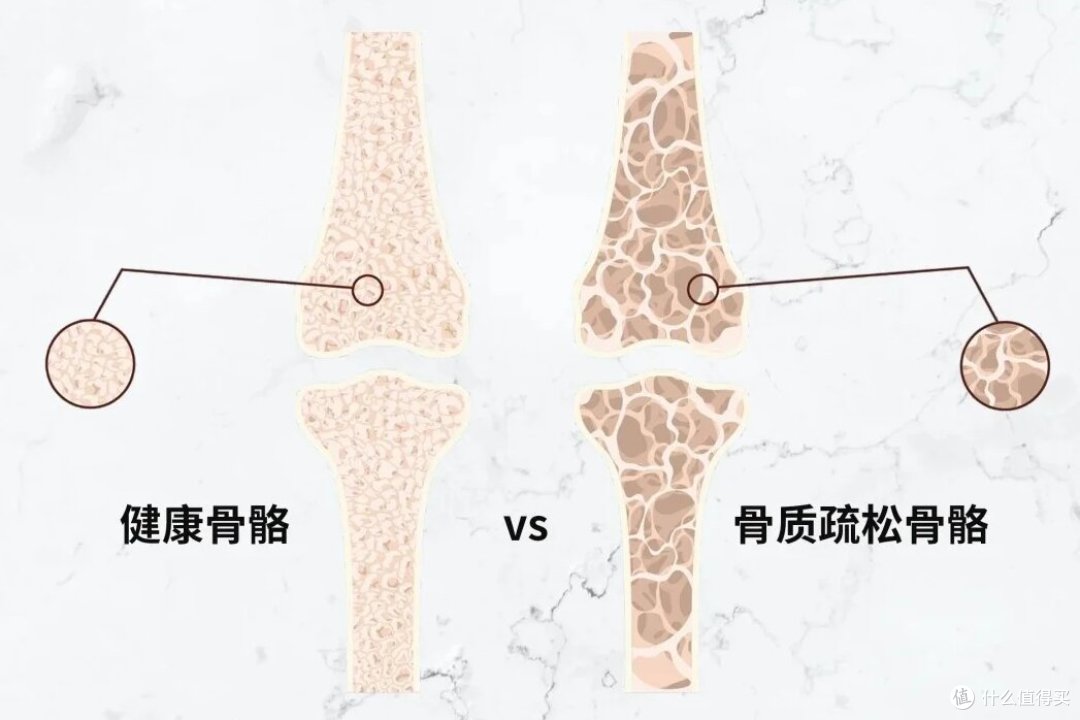 膝盖疼?90% 的人都忽略这 6 个原因,第 4 个年轻人最易中招