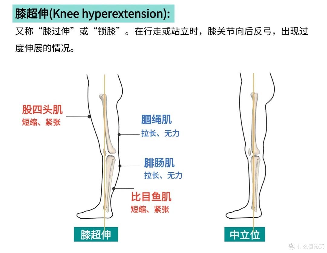 膝关节总疼?骨科康复师:不是‘老了’,是这 4 个原因!