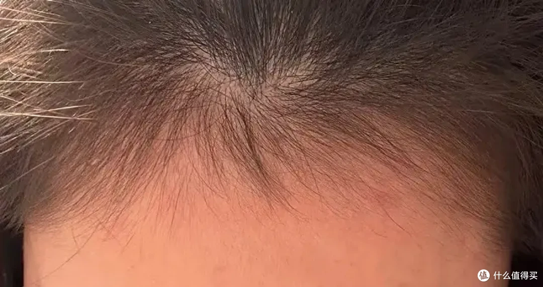 直击发缝问题!育妍堂精准滋养,绒毛发越养越粗