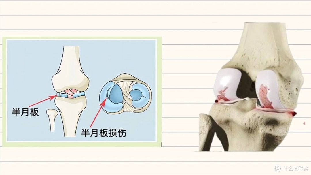 膝盖咔咔响?是正常现象还是健康警报?康复师教你3招自救