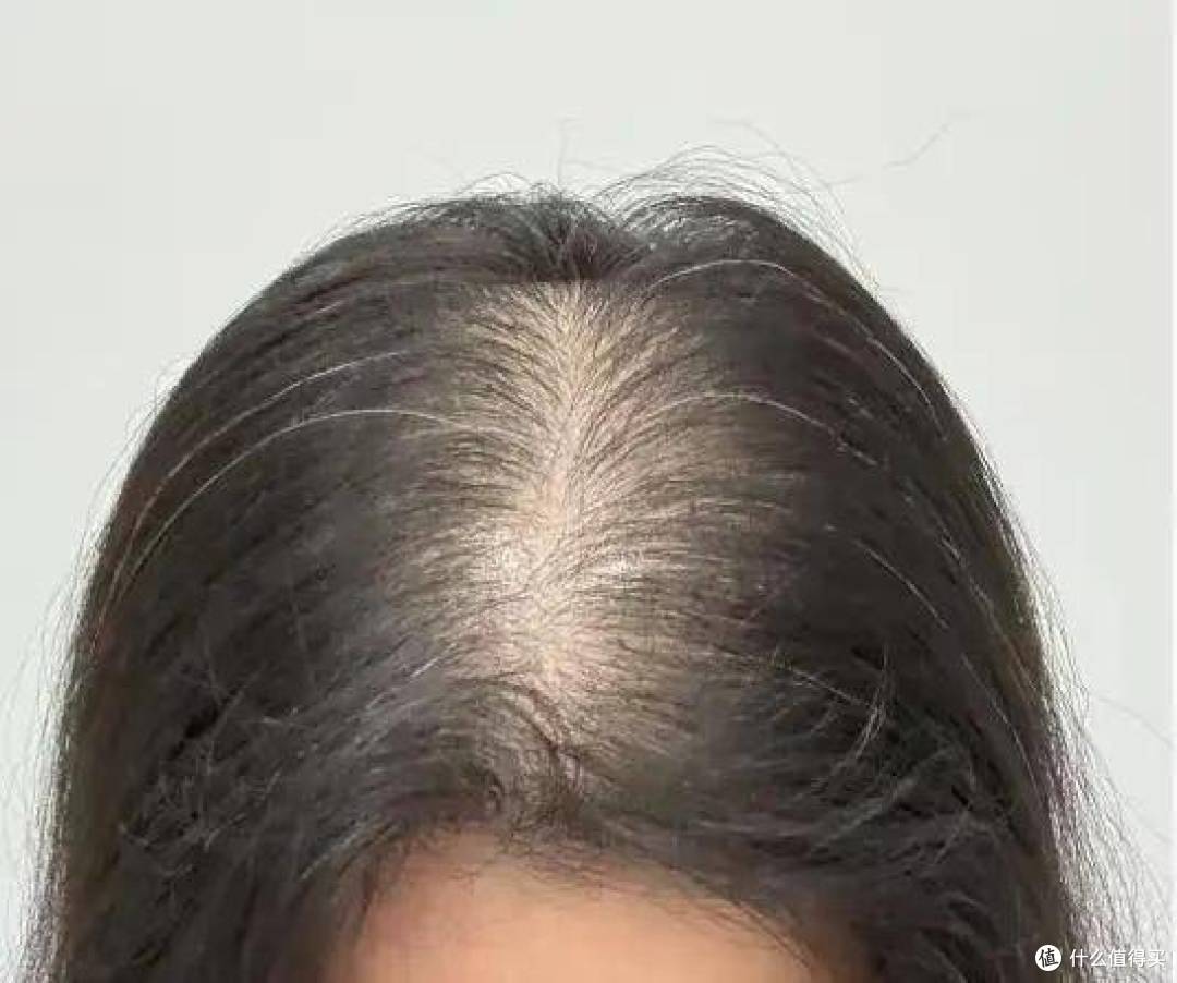 发根稳,头发顺,育妍堂护养更贴心