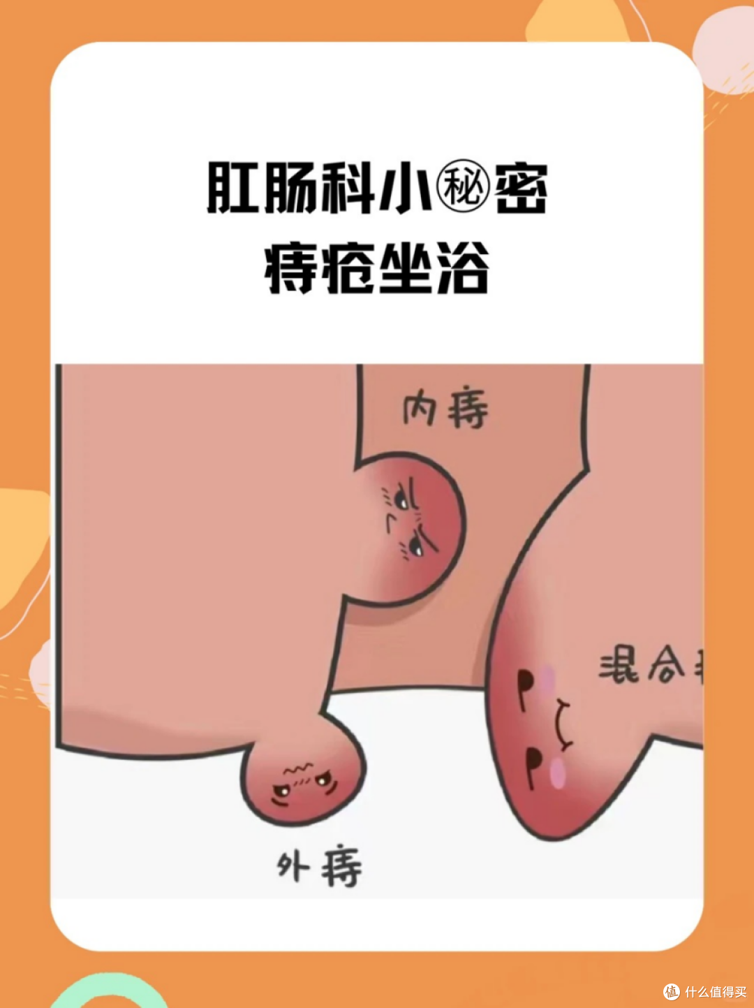 痔疮护理的关键——坐浴!说说坐浴的好处~