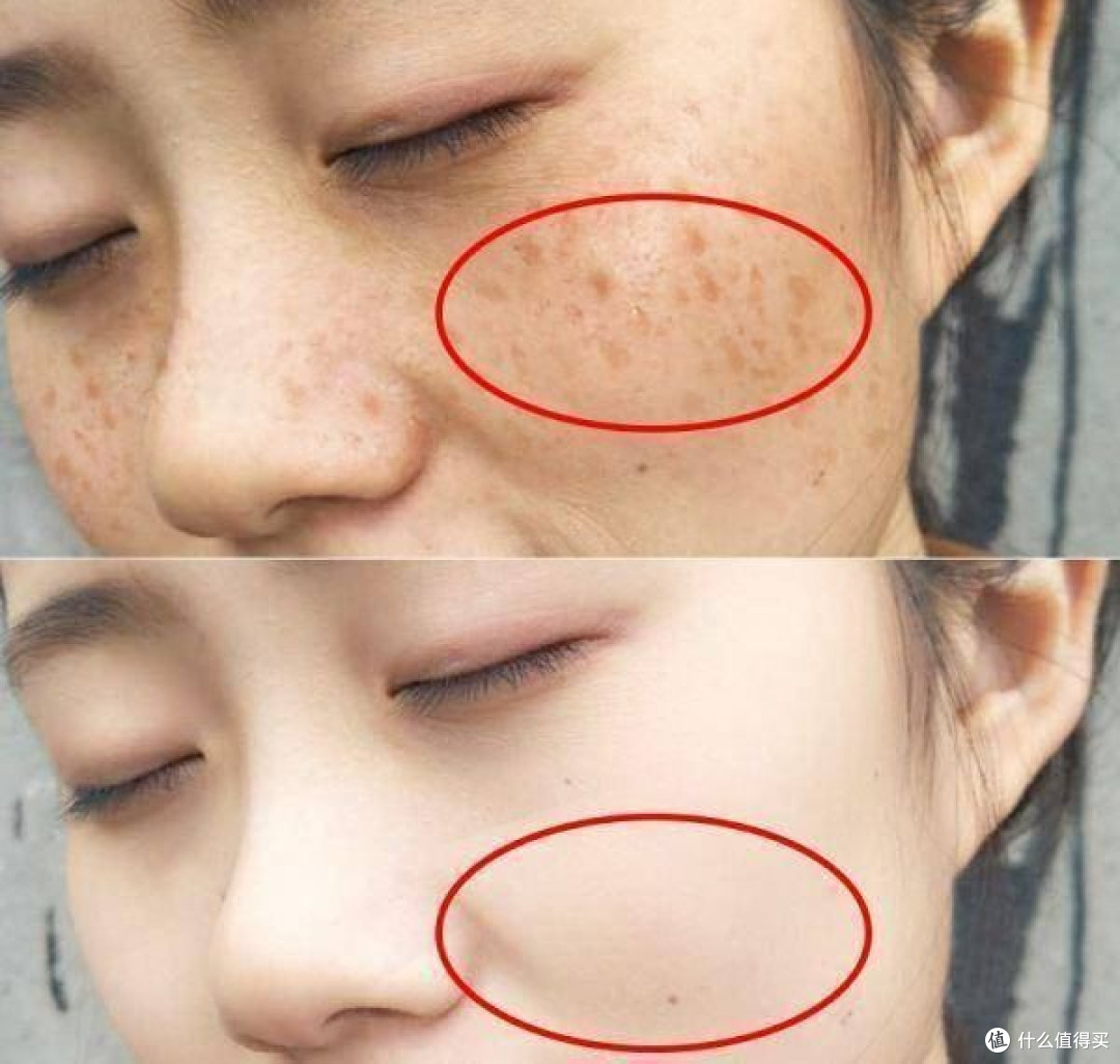 抗皱祛斑用什么护肤品好，美白祛斑霜效果最好的排名第一值得入手