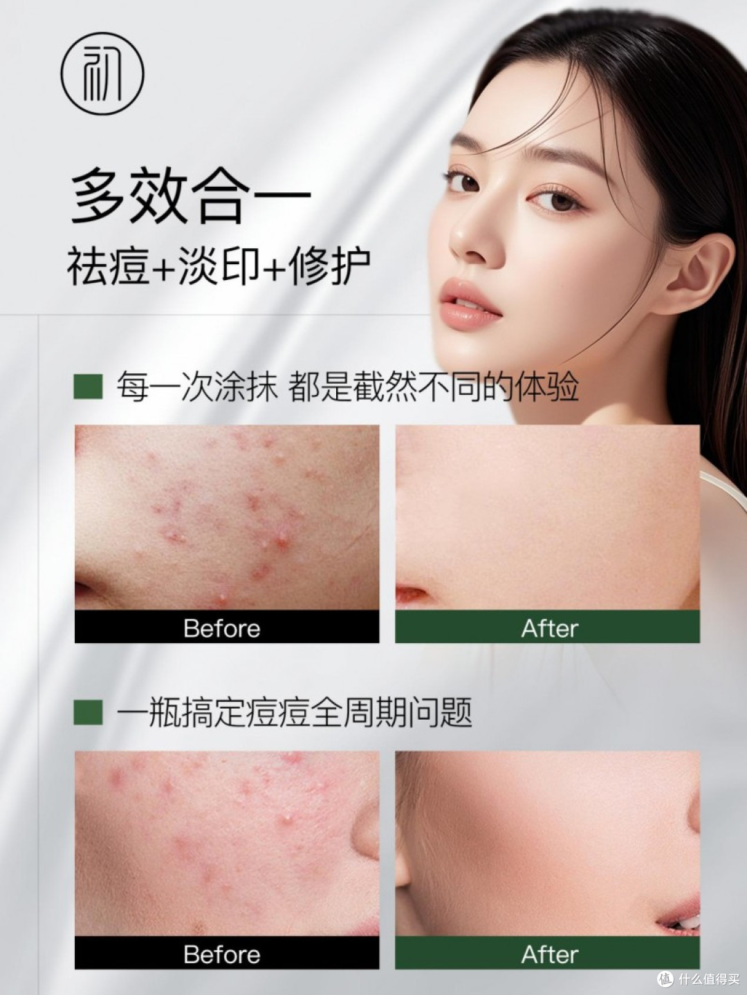 祛痘品牌排行前十名公布,祛痘产品推荐学生党,十大好用祛痘精华