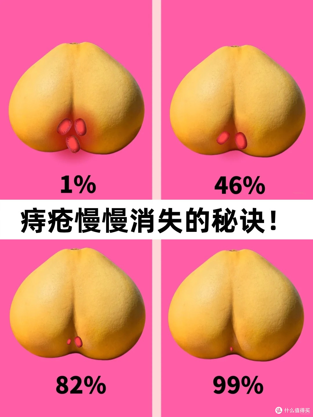 痔疮可以自愈吗?长了痔疮不想手术怎么办?