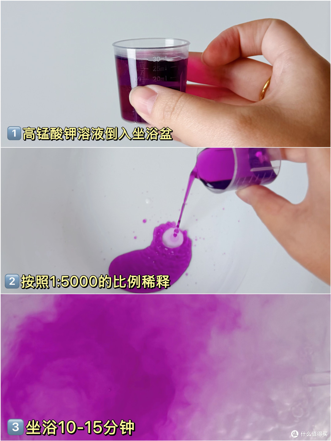 身体可能长痔疮的表现！得了痔疮该如何缓解？
