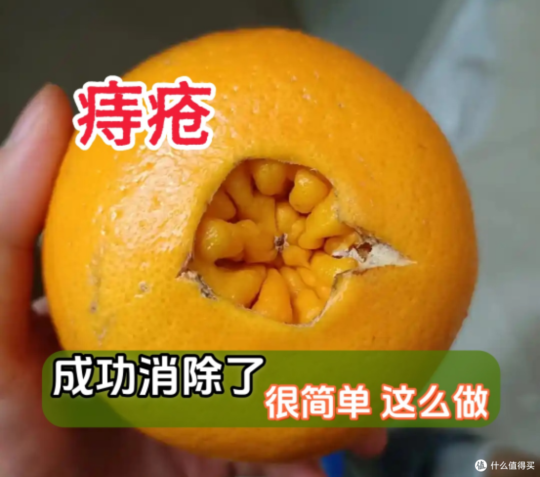 亲身试验后总结:这三个方法让我的痔疮终于消停了