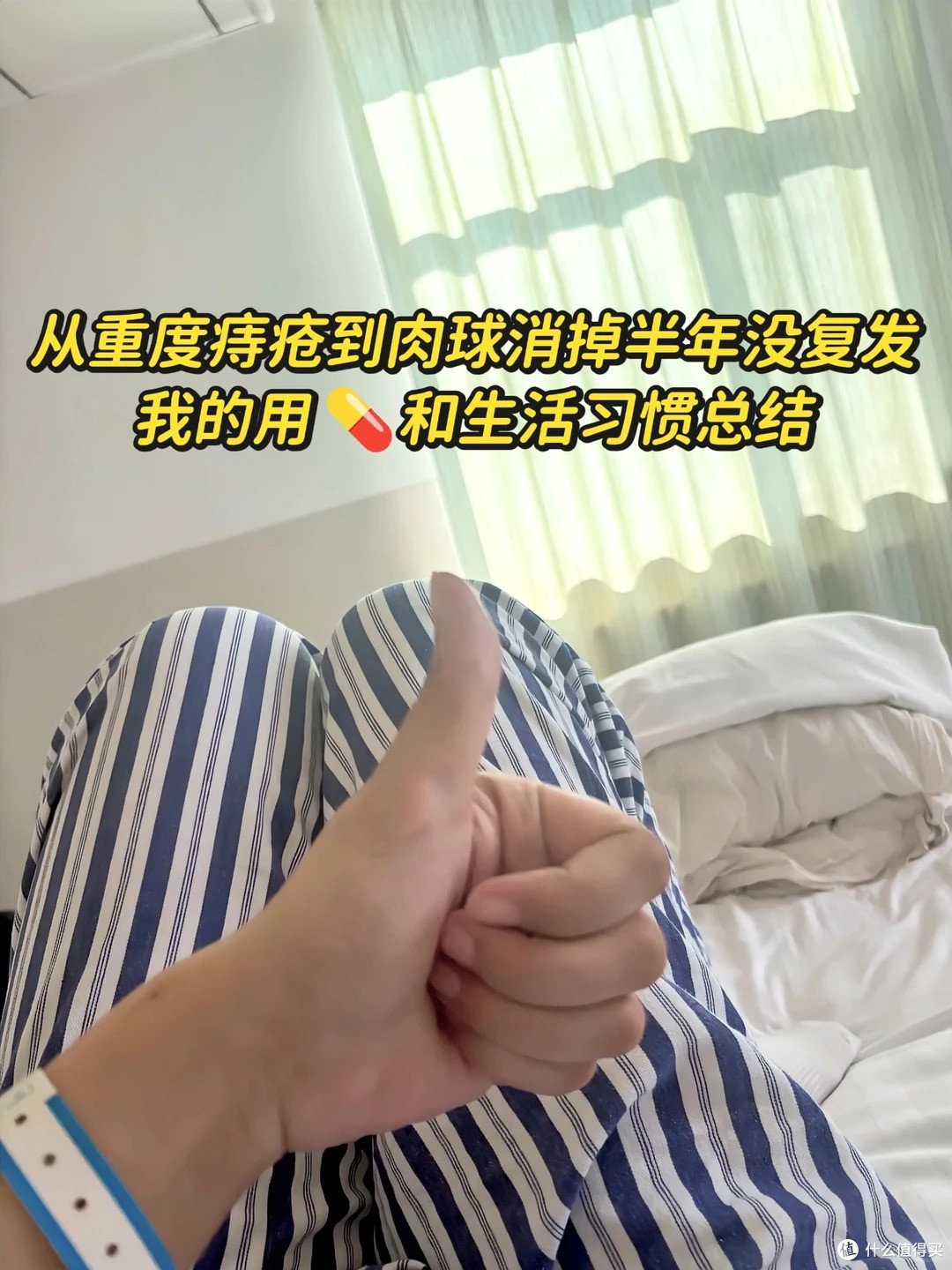 混合痔二期,便血肉球全都出现了!