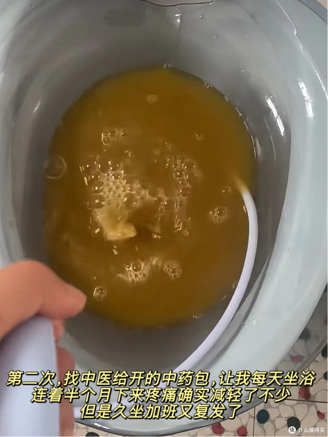 痔疮3年即将上岸,记录我的心路历程....