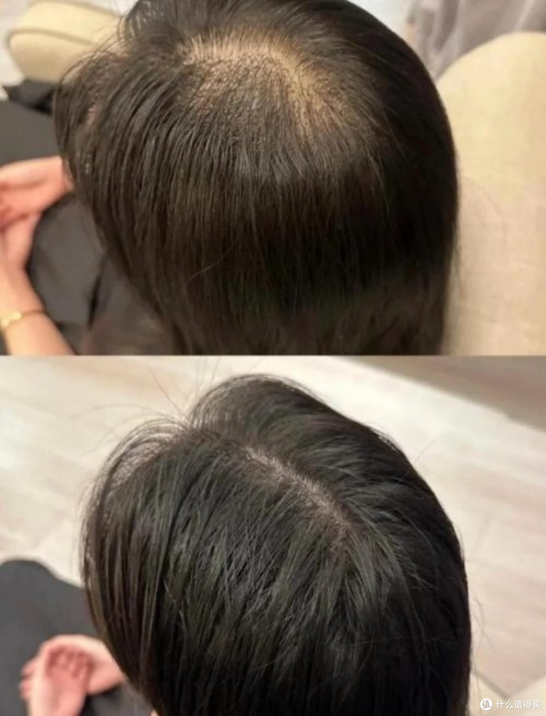 防脱发洗发水什么品牌好,2025权威榜单洗发水前十:国家认证防脱