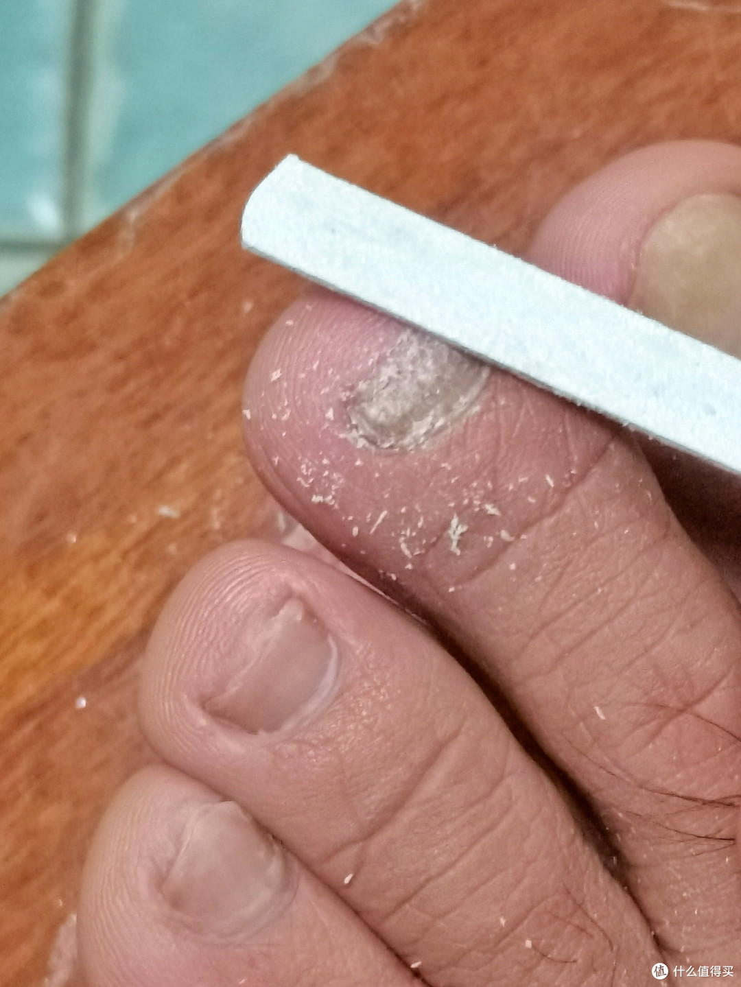 得了灰指甲，不怕传染两--两款半国产和进口灰指甲擦剂对比