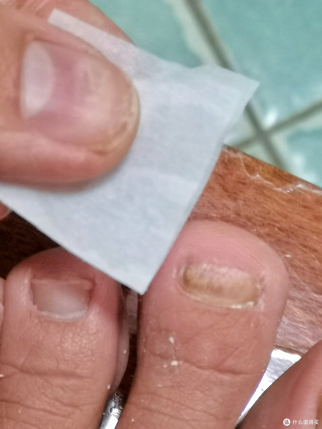 得了灰指甲，不怕传染两--两款半国产和进口灰指甲擦剂对比