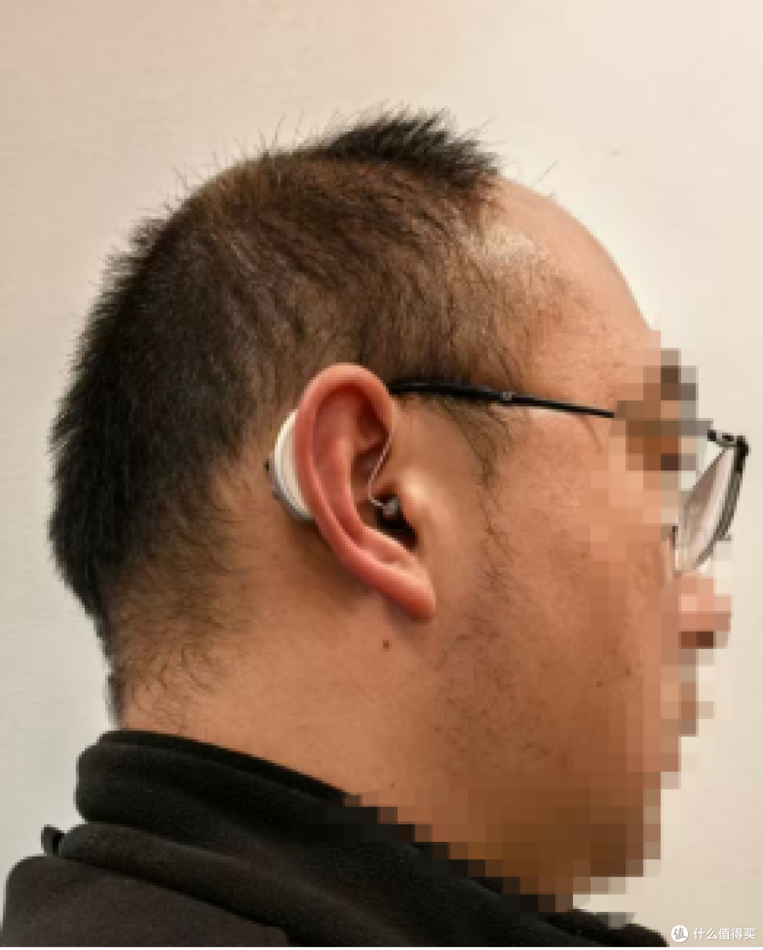 听力损伤会逐渐严重到耳聋嘛?助听器有必要吗?