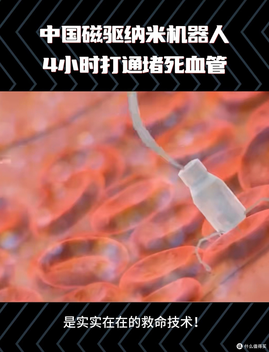 打一针,4小时疏通血管:中国磁驱纳米机器人如何改写救命规则?