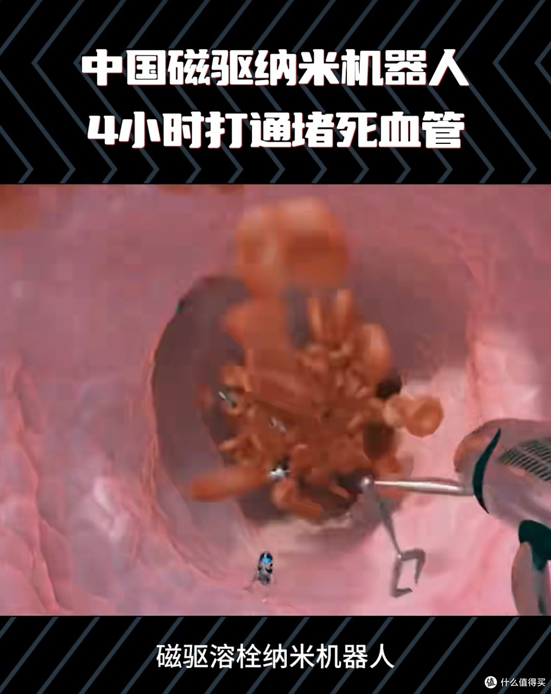 打一针,4小时疏通血管:中国磁驱纳米机器人如何改写救命规则?
