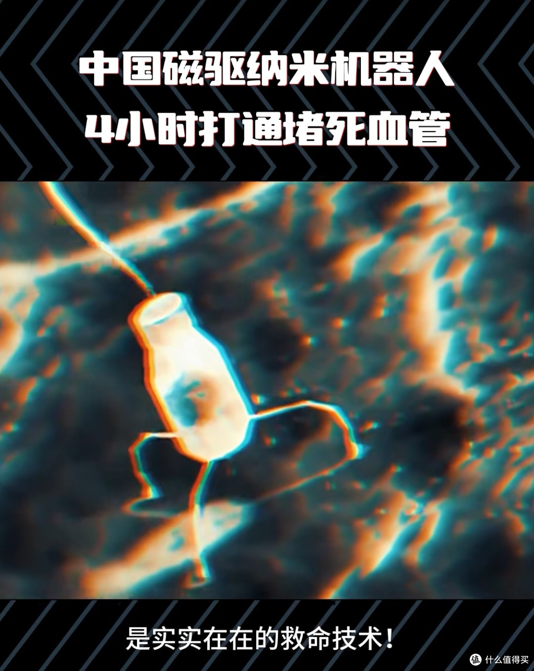 打一针,4小时疏通血管:中国磁驱纳米机器人如何改写救命规则?