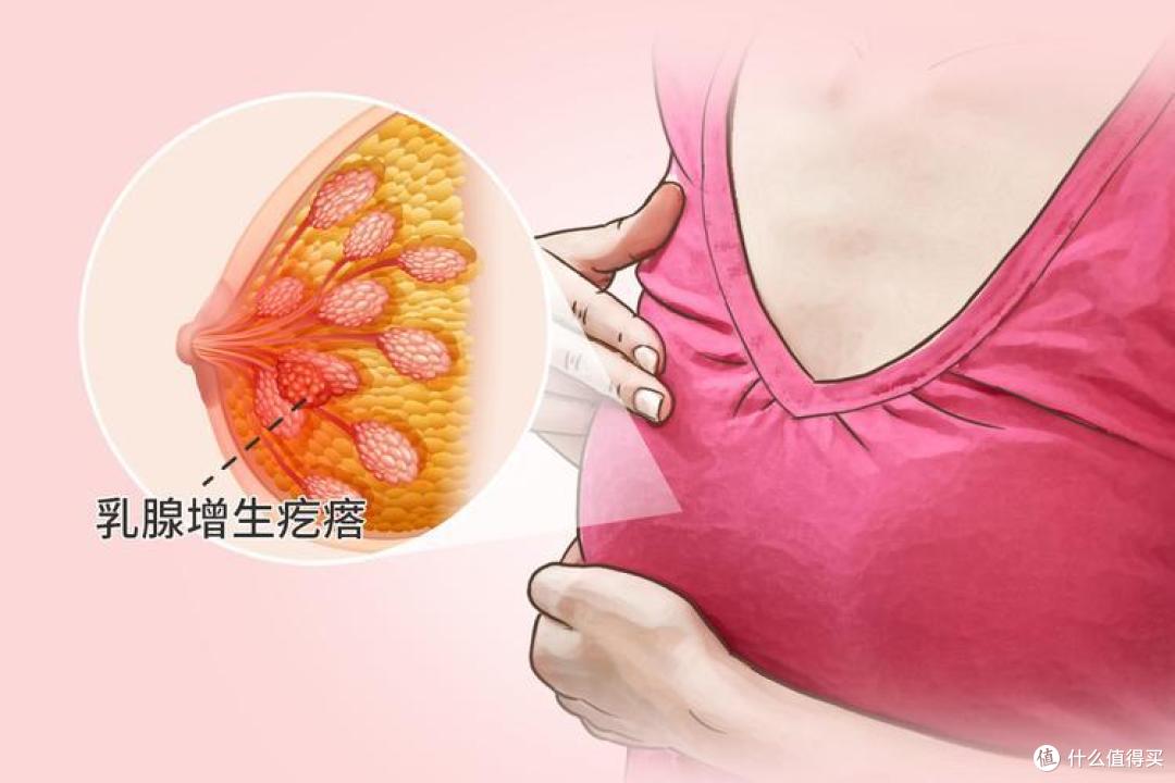 别再吓自己!体检报告这些“病”其实不用治