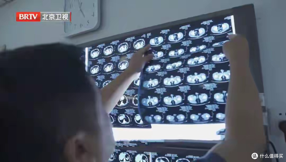 一年做几次CT会致癌?低于这个次数,就不用担心!