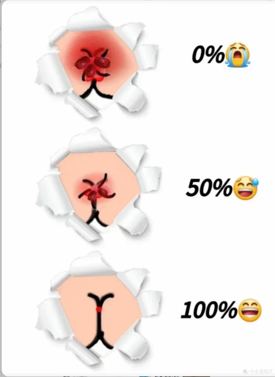 痔疮疼痛难忍,在家就能快速缓解的奇招!