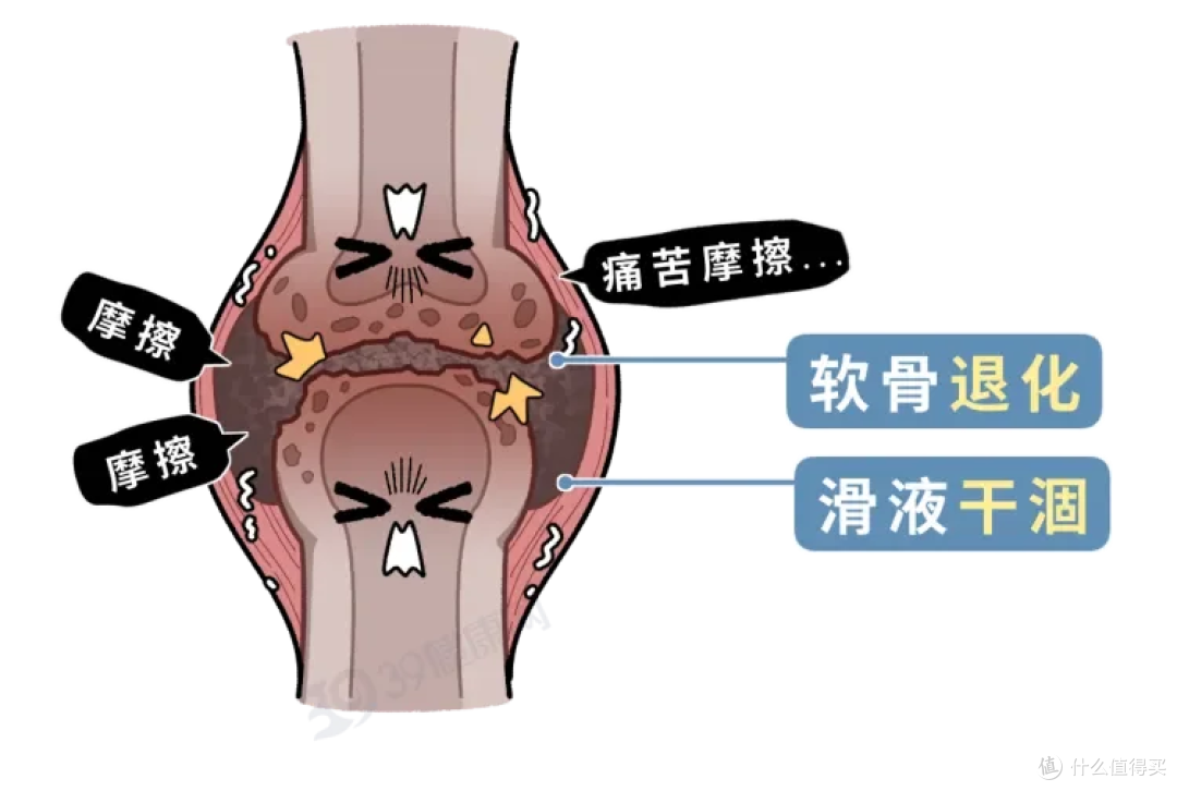 骨科医生私藏的四个减负动作,练对动作养膝盖,走错路子毁关节!
