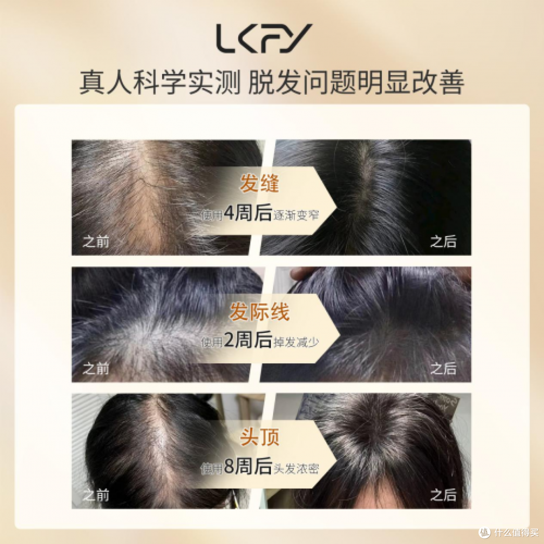 什么防脱生发产品效果最好?熬夜脱发应对,防脱产品排行榜前十