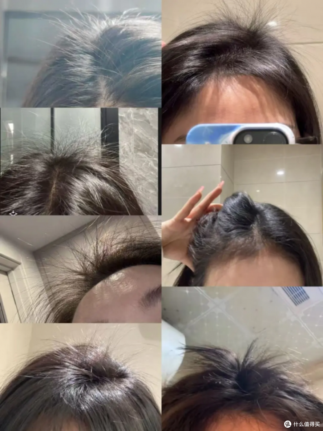 什么防脱生发产品效果最好?熬夜脱发应对,防脱产品排行榜前十
