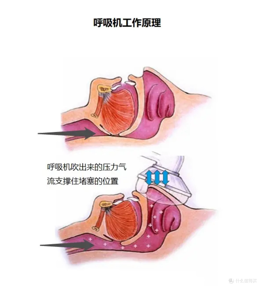 经常半夜憋醒、打鼾严重，想买个呼吸机，哪个品牌最值得推荐？