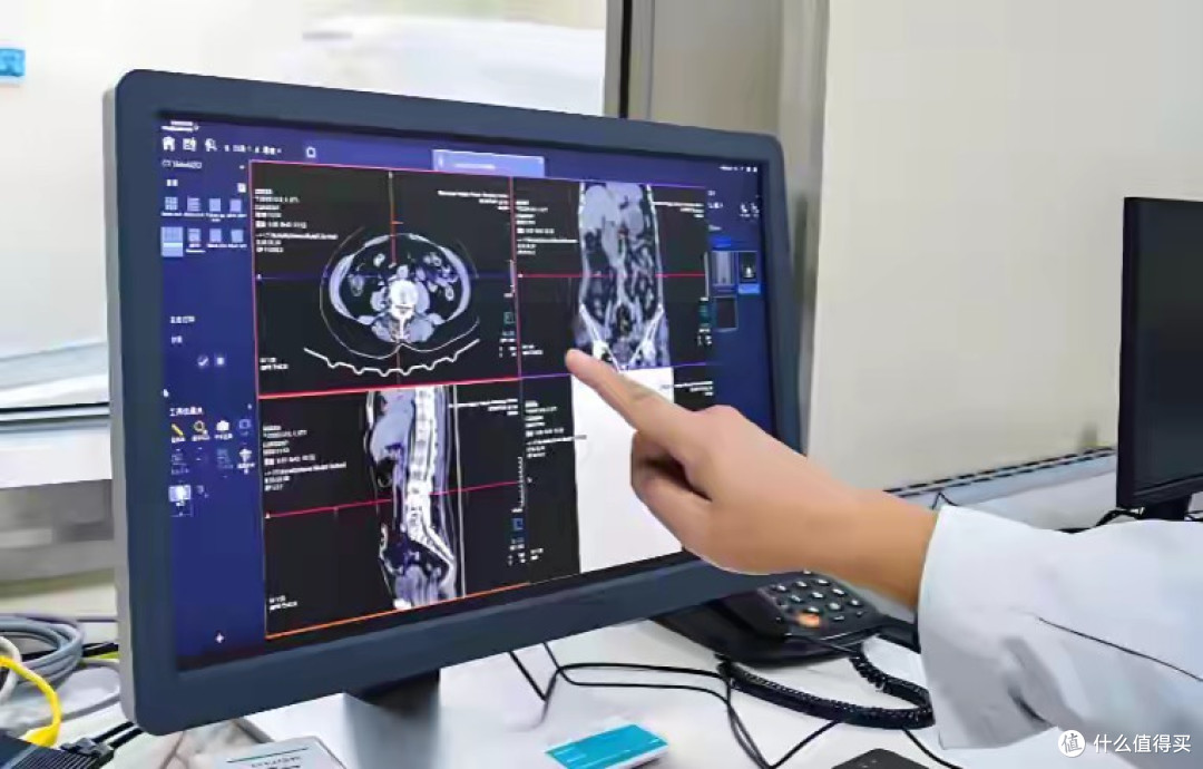 癌症患者的困惑:美国已经不打化疗了,为何中国还要不停地化疗?