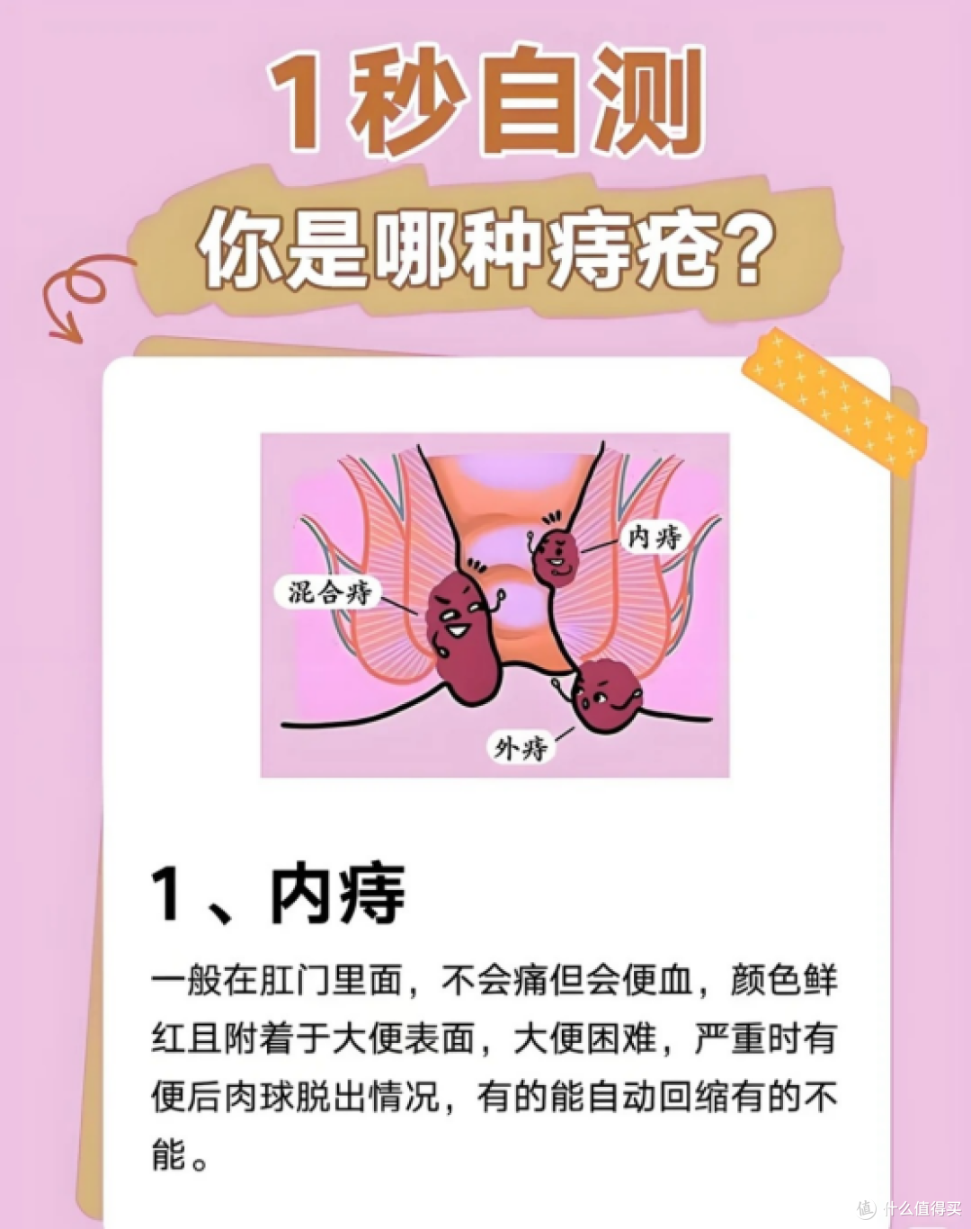 痔疮不适别慌张,分情况处理更轻松