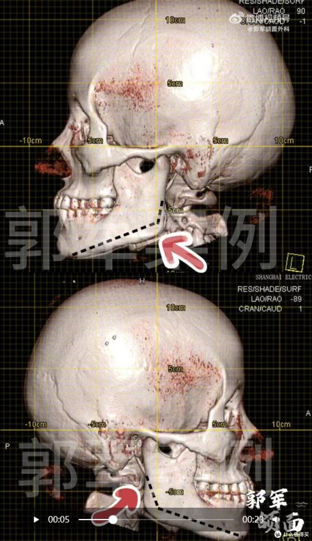 引领“骨相革命”:郭军教授以“悄悄变美”哲学,重塑高级抗衰
